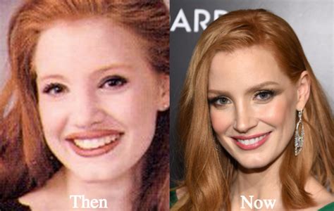 jessica chastain plastic surgery|The Stunning Transformation Of Jessica Chastain